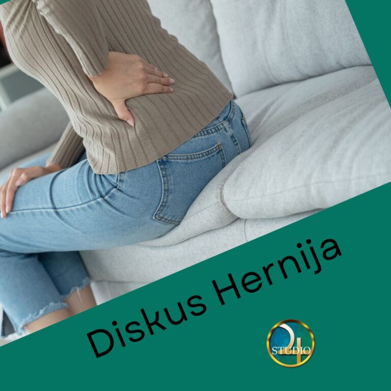 diskus hernija